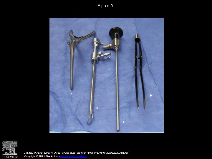 Figure 5 Journal of Hand Surgery Global Online 2021 3210 -214 DOI: (10. 1016/j.