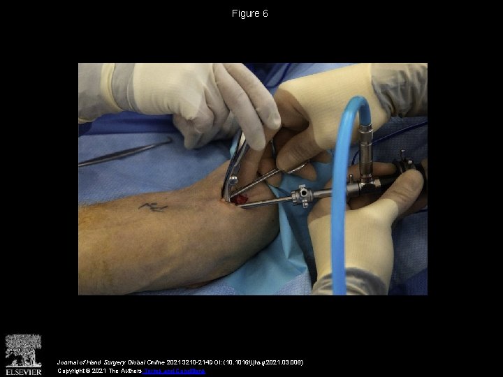 Figure 6 Journal of Hand Surgery Global Online 2021 3210 -214 DOI: (10. 1016/j.