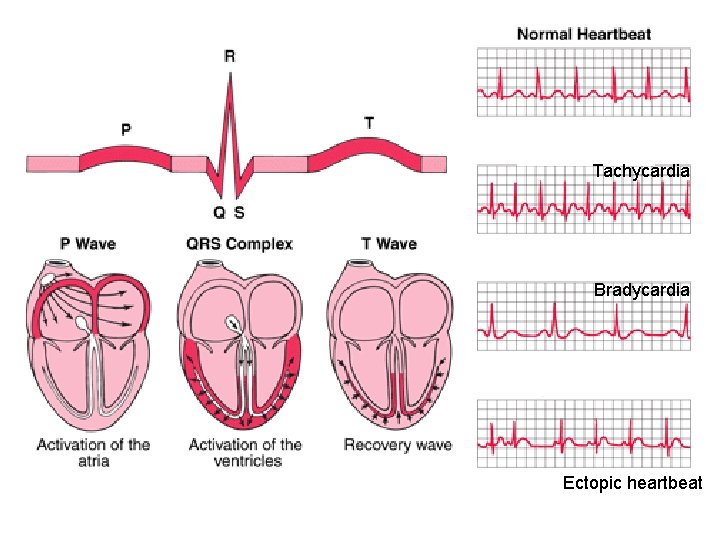 Tachycardia Bradycardia Ectopic heartbeat 