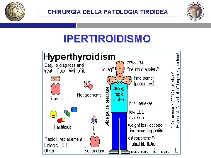 CHIRURGIA DELLA PATOLOGIA TIROIDEA IPERTIROIDISMO 