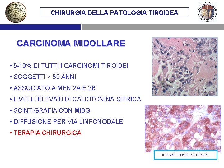 CHIRURGIA DELLA PATOLOGIA TIROIDEA CARCINOMA MIDOLLARE • 5 -10% DI TUTTI I CARCINOMI TIROIDEI