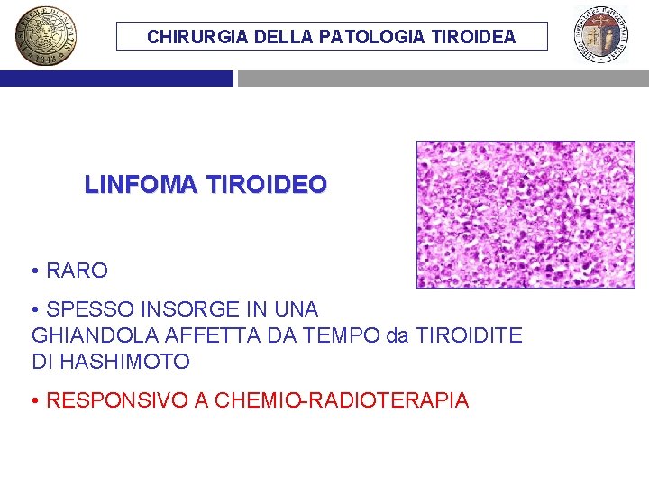 CHIRURGIA DELLA PATOLOGIA TIROIDEA LINFOMA TIROIDEO • RARO • SPESSO INSORGE IN UNA GHIANDOLA