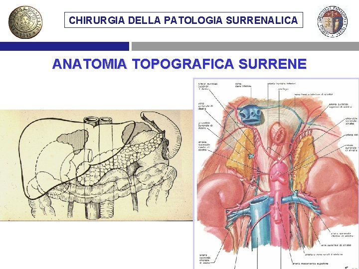 CHIRURGIA DELLA PATOLOGIA SURRENALICA ANATOMIA TOPOGRAFICA SURRENE 