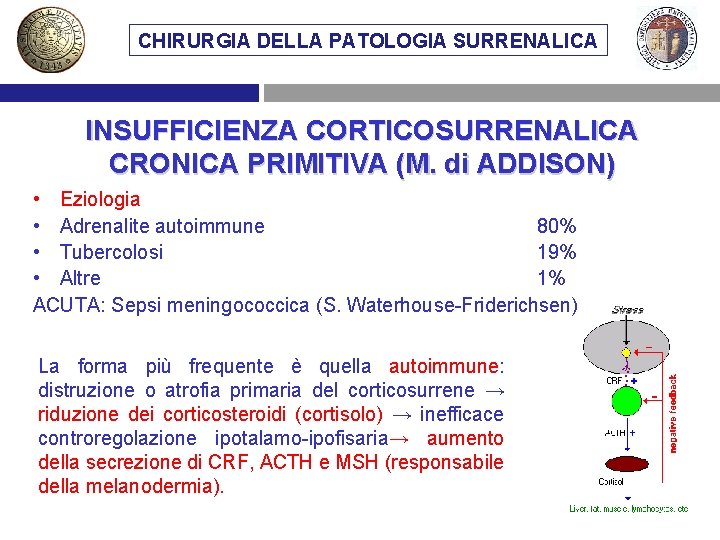 CHIRURGIA DELLA PATOLOGIA SURRENALICA INSUFFICIENZA CORTICOSURRENALICA CRONICA PRIMITIVA (M. di ADDISON) • Eziologia •