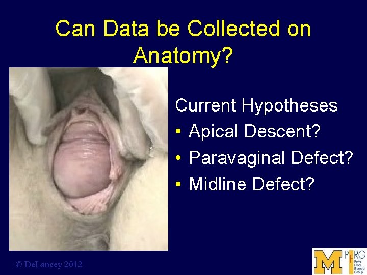 Can Data be Collected on Anatomy? Current Hypotheses • Apical Descent? • Paravaginal Defect?