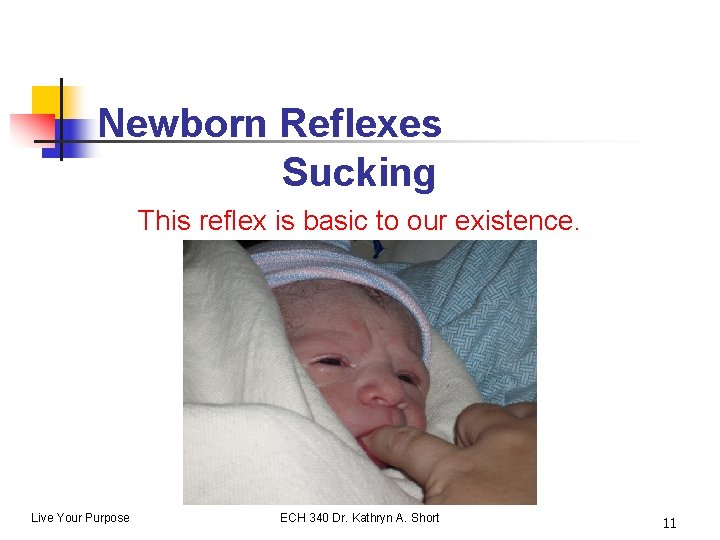Newborn Reflexes Sucking This reflex is basic to our existence. Live Your Purpose ECH