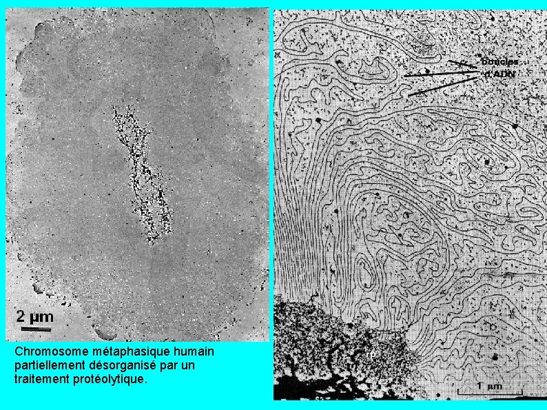 Chromosome métaphasique humain partiellement désorganisé par un traitement protéolytique. 