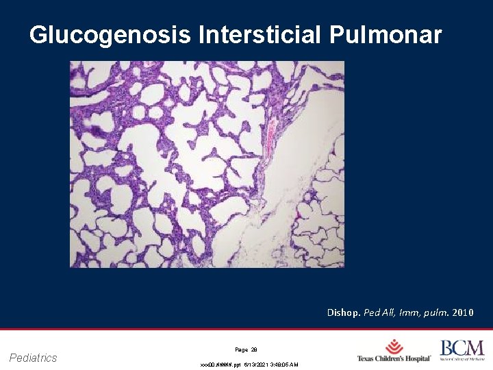Glucogenosis Intersticial Pulmonar Dishop. Ped All, Imm, pulm. 2010 Pediatrics Page 28 xxx 00.