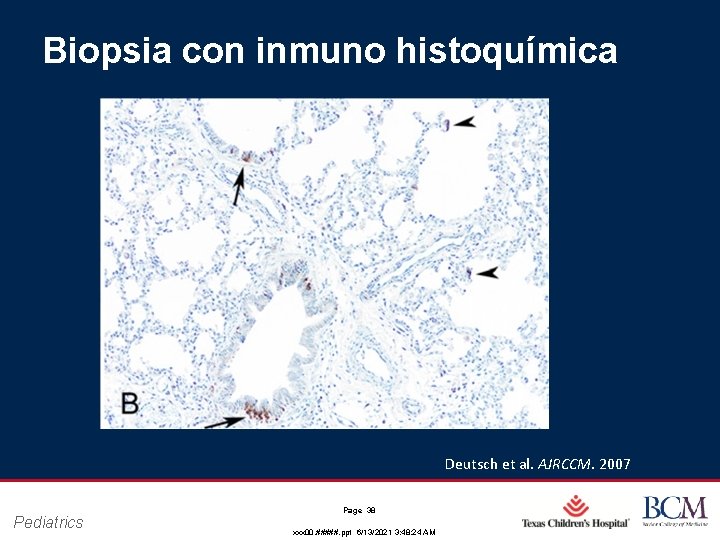 Biopsia con inmuno histoquímica Deutsch et al. AJRCCM. 2007 Pediatrics Page 38 xxx 00.