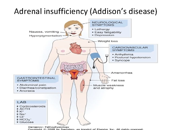 Adrenal insufficiency (Addison’s disease) 