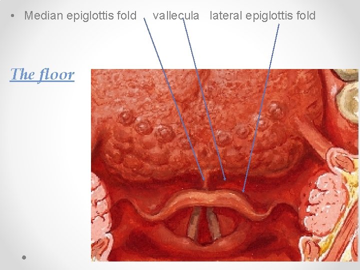  • Median epiglottis fold The floor vallecula lateral epiglottis fold 