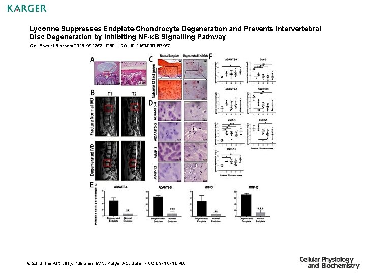 Lycorine Suppresses Endplate-Chondrocyte Degeneration and Prevents Intervertebral Disc Degeneration by Inhibiting NF-κB Signalling Pathway