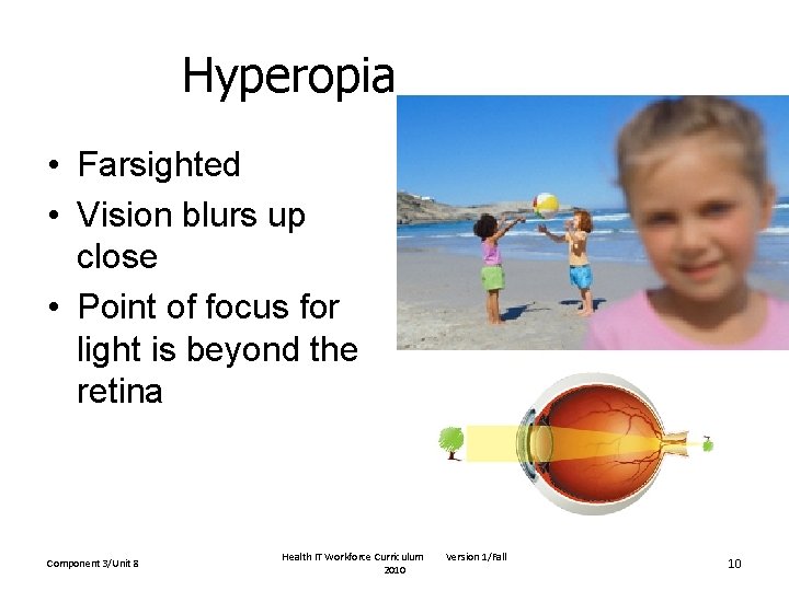 Hyperopia • Farsighted • Vision blurs up close • Point of focus for light