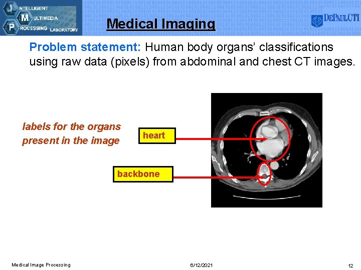 Medical Imaging Problem statement: Human body organs’ classifications using raw data (pixels) from abdominal