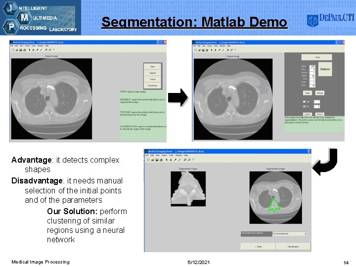 Segmentation: Matlab Demo Advantage: it detects complex shapes Disadvantage: it needs manual selection of