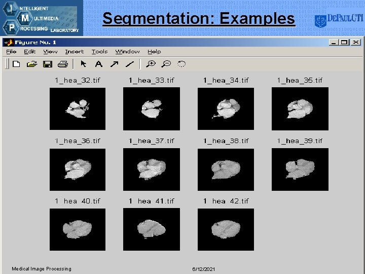 Segmentation: Examples Medical Image Processing 6/12/2021 15 