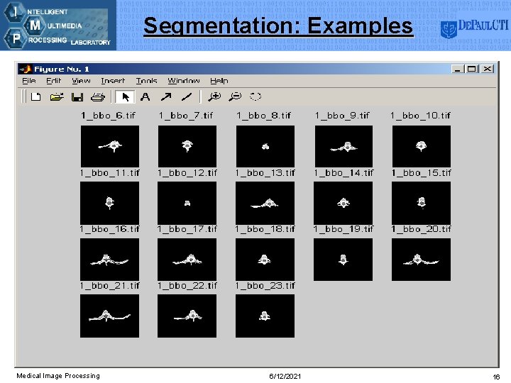 Segmentation: Examples Medical Image Processing 6/12/2021 16 