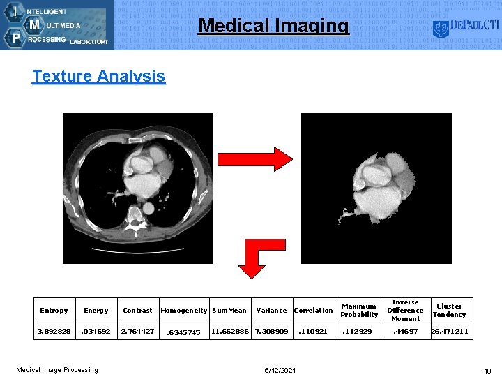 Medical Imaging Texture Analysis Entropy Energy Contrast 3. 892828 . 034692 2. 764427 Medical