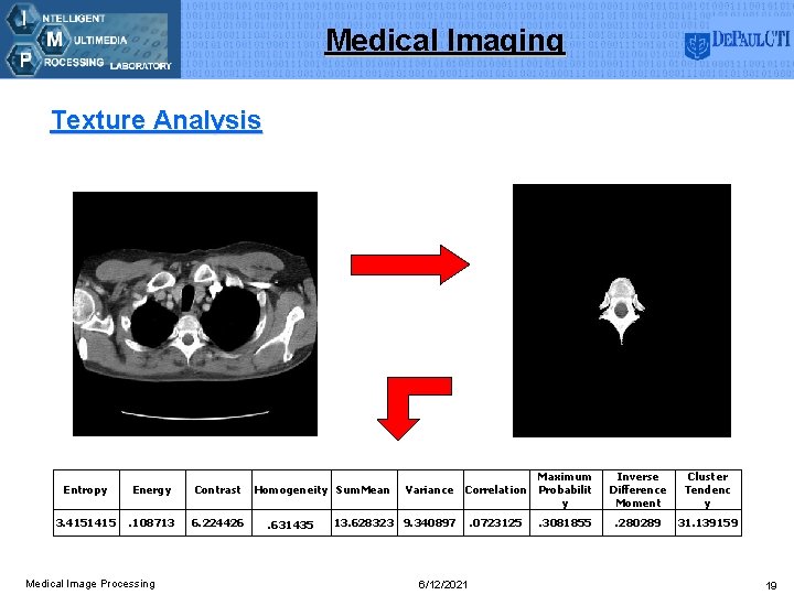 Medical Imaging Texture Analysis Entropy Energy Contrast 3. 4151415 . 108713 6. 224426 Medical