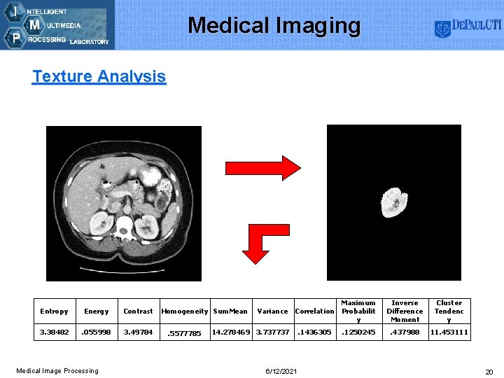 Medical Imaging Texture Analysis Entropy Energy Contrast 3. 38482 . 055998 3. 49784 Medical