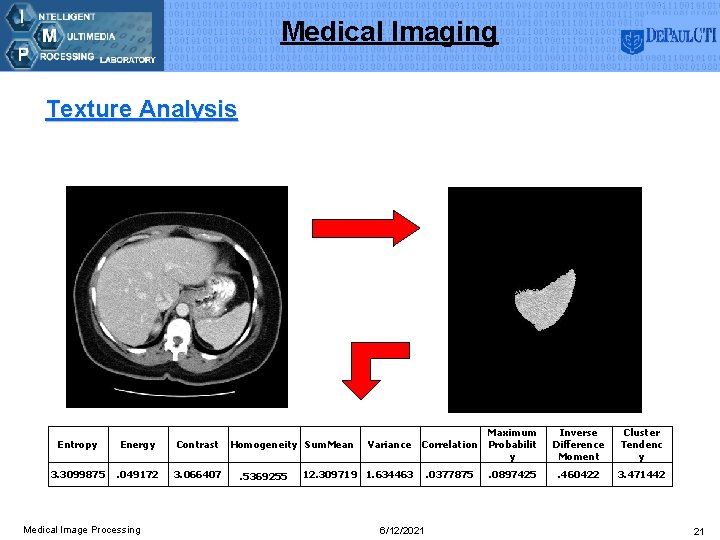 Medical Imaging Texture Analysis Entropy Energy Contrast 3. 3099875 . 049172 3. 066407 Medical