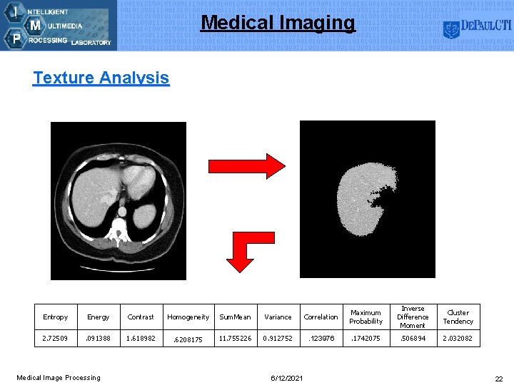 Medical Imaging Texture Analysis Entropy Energy Contrast Homogeneity Sum. Mean Variance Correlation Maximum Probability