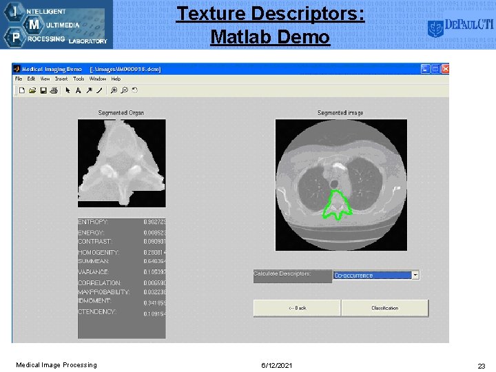 Texture Descriptors: Matlab Demo Medical Image Processing 6/12/2021 23 