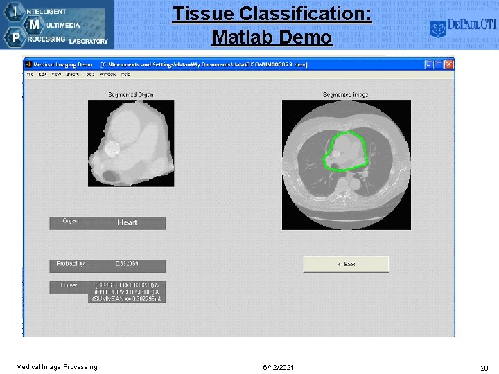 Tissue Classification: Matlab Demo Medical Image Processing 6/12/2021 28 