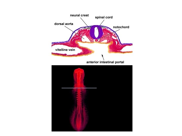 OUR AXIS anterior rostral dorsal posterior caudal ventral