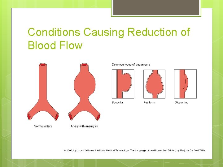 Conditions Causing Reduction of Blood Flow 