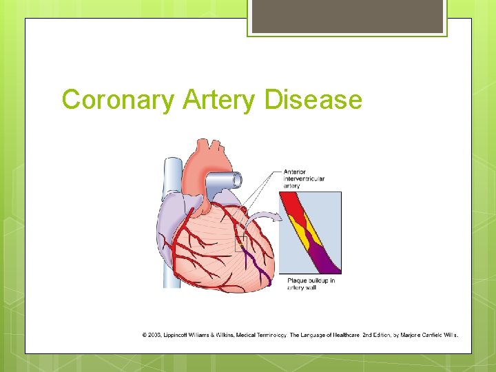 Coronary Artery Disease 