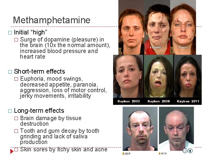 Methamphetamine � Initial � “high” Surge of dopamine (pleasure) in the brain (10 x