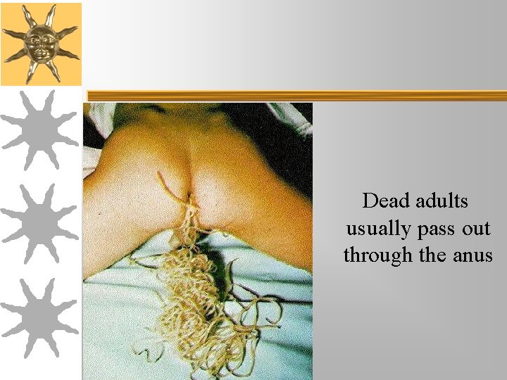 Dead adults usually pass out through the anus Dead adults usually pass out through the anus