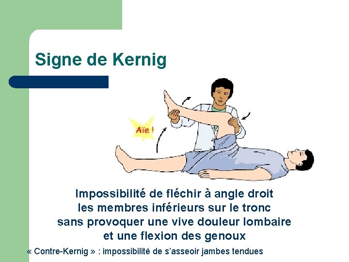 Signe de Kernig Impossibilité de fléchir à angle droit les membres inférieurs sur le