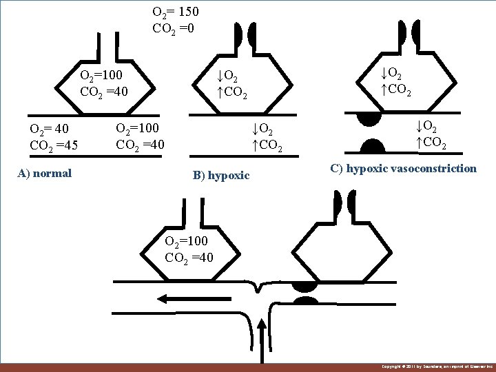 O 2= 150 CO 2 =0 O 2= 40 CO 2 =45 A) normal O 2= 150 CO 2 =0 O 2= 40 CO 2 =45 A) normal