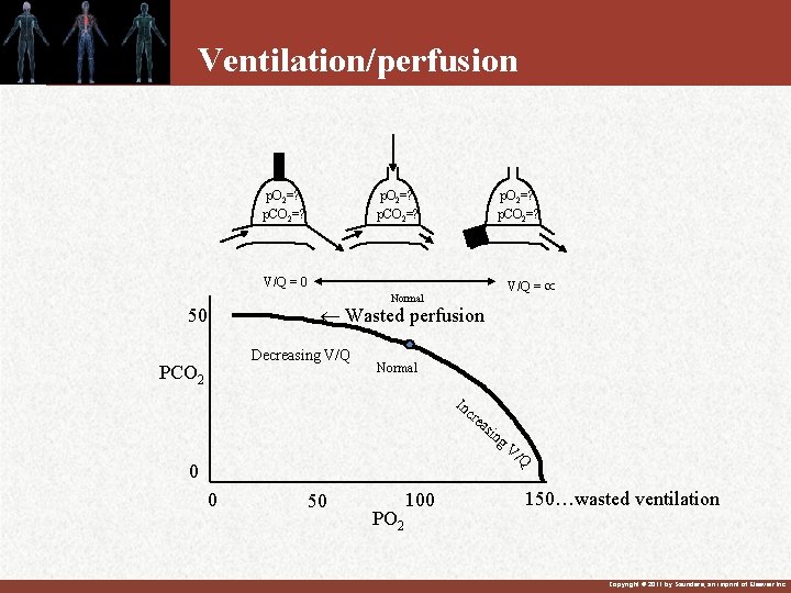 Ventilation/perfusion p. O 2=? p. CO 2=? V/Q = 0 V/Q = Normal Wasted Ventilation/perfusion p. O 2=? p. CO 2=? V/Q = 0 V/Q = Normal Wasted