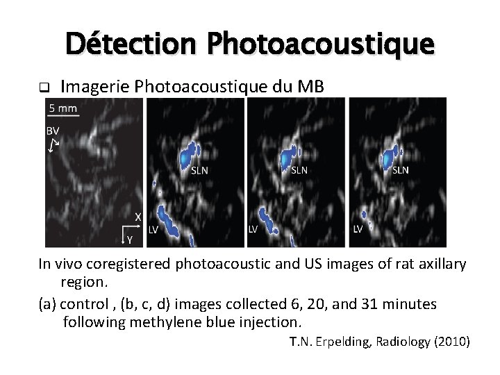 Détection Photoacoustique q Imagerie Photoacoustique du MB In vivo coregistered photoacoustic and US images