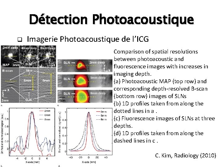 Détection Photoacoustique q Imagerie Photoacoustique de l’ICG Comparison of spatial resolutions between photoacoustic and