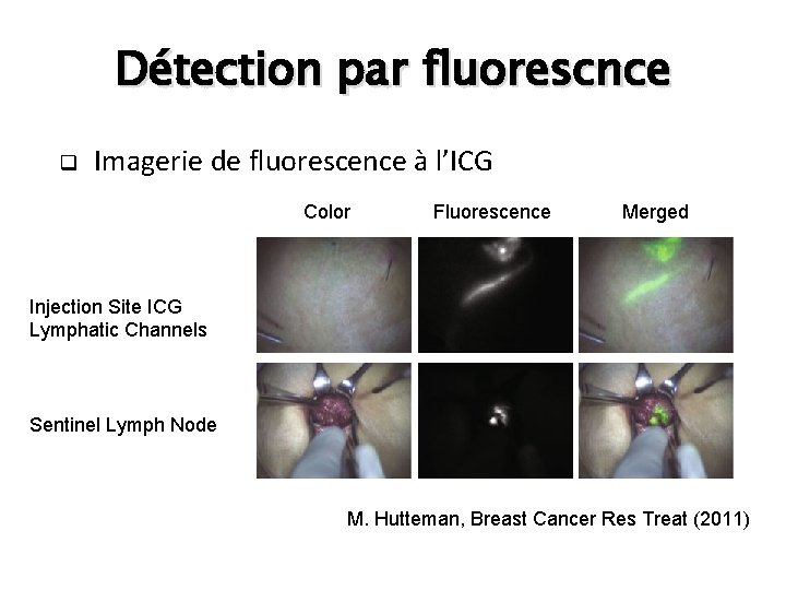 Détection par fluorescnce q Imagerie de fluorescence à l’ICG Color Fluorescence Merged Injection Site