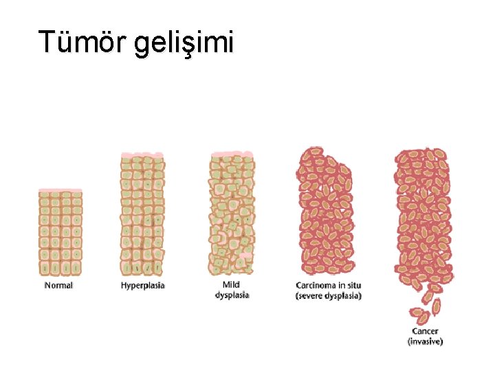 Tümör gelişimi 