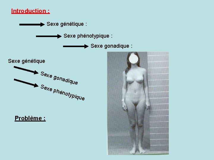 Introduction : Sexe génétique : Sexe phénotypique : Sexe gonadique : Sexe génétique Sexe
