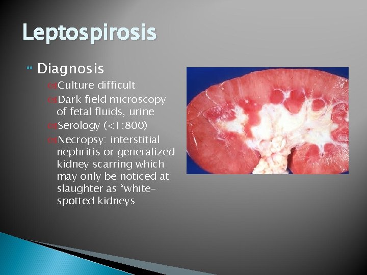 Leptospirosis Diagnosis Culture difficult Dark field microscopy of fetal fluids, urine Serology (<1: 800)