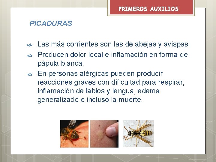 PRIMEROS AUXILIOS PICADURAS Las más corrientes son las de abejas y avispas. Producen dolor