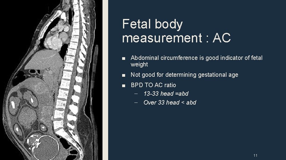 Fetal body measurement : AC ■ Abdominal circumference is good indicator of fetal weight