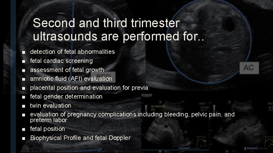 Second and third trimester ultrasounds are performed for. . ■ ■ ■ ■ detection