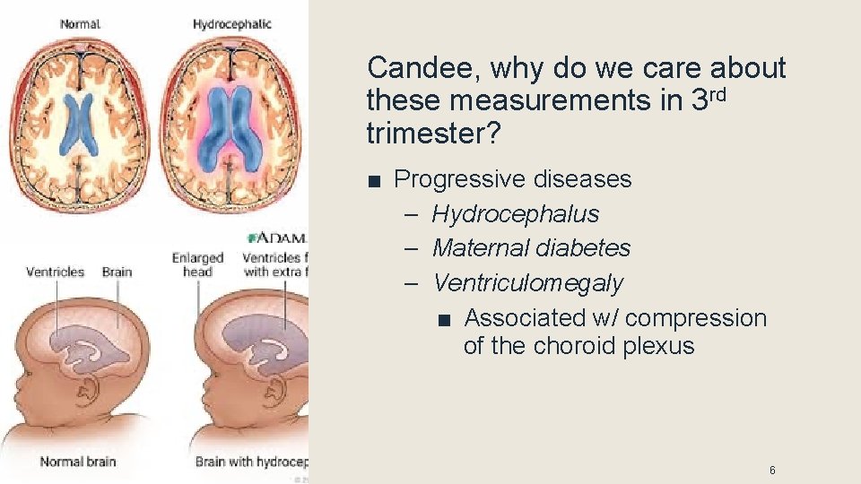 Candee, why do we care about these measurements in 3 rd trimester? ■ Progressive