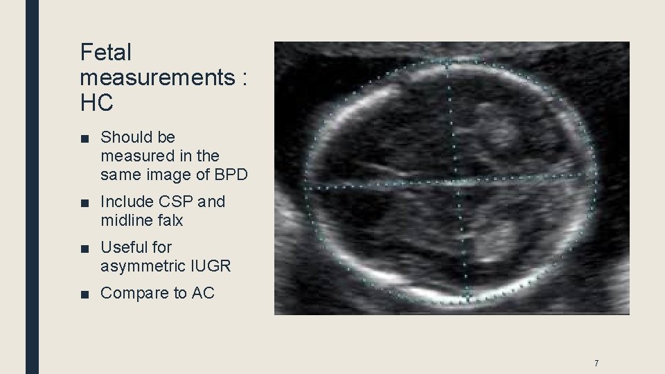 Fetal measurements : HC ■ Should be measured in the same image of BPD