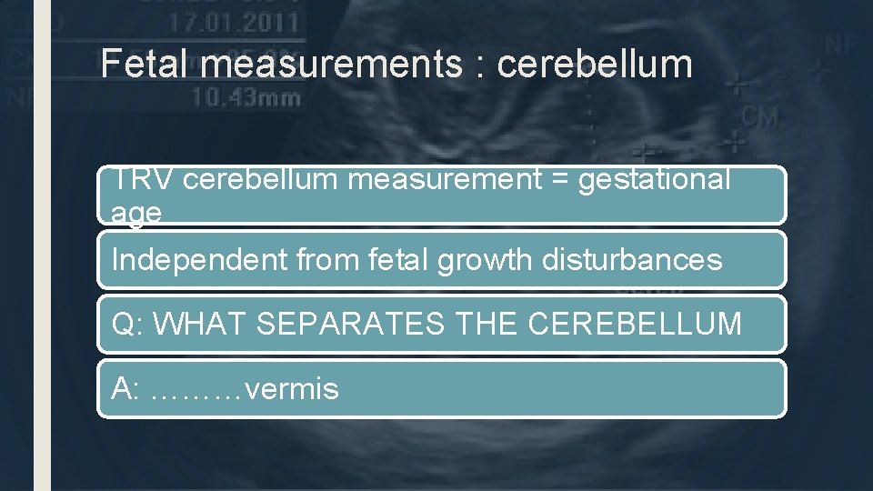 Fetal measurements : cerebellum TRV cerebellum measurement = gestational age Independent from fetal growth