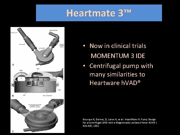 Heartmate 3™ • Now in clinical trials MOMENTUM 3 IDE • Centrifugal pump with