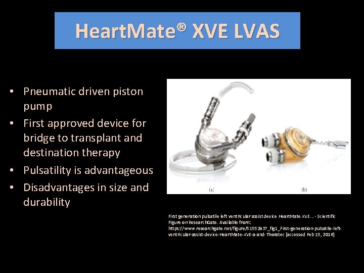 Heart. Mate® XVE LVAS • Pneumatic driven piston pump • First approved device for